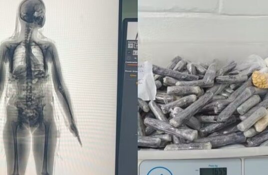 Scanner corporal flagra mulher com material ilícito em presídio