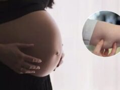 Mulher engravida após falha em implante contraceptivo e recebe R$ 30 mil por danos morais em SC