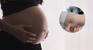 Mulher engravida após falha em implante contraceptivo e recebe R$ 30 mil por danos morais em SC