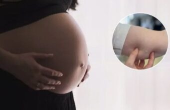 Mulher engravida após falha em implante contraceptivo e recebe R$ 30 mil por danos morais em SC
